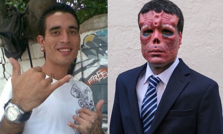 Un joven de Ourense se convierte en "Cráneo Rojo"